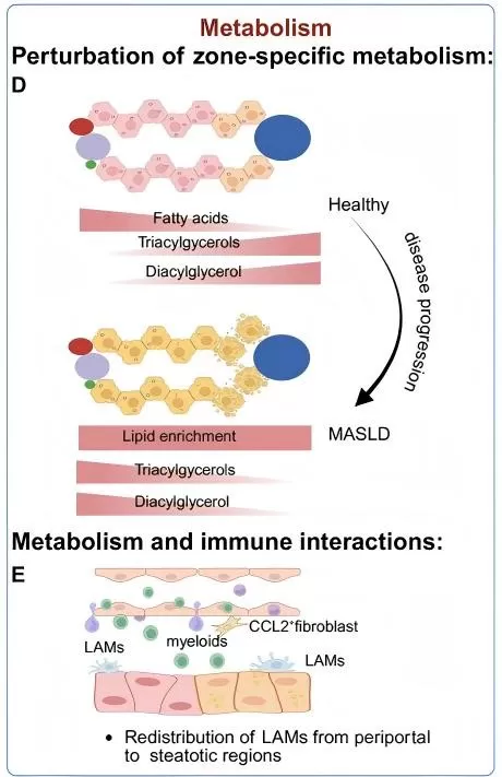 Disruption of Zone-Specific Metabolism and Immune Interactions in Liver Disease Progression. Disruption of Zone-Specific Metabolism and Immune Interactions in Liver Disease Progression.